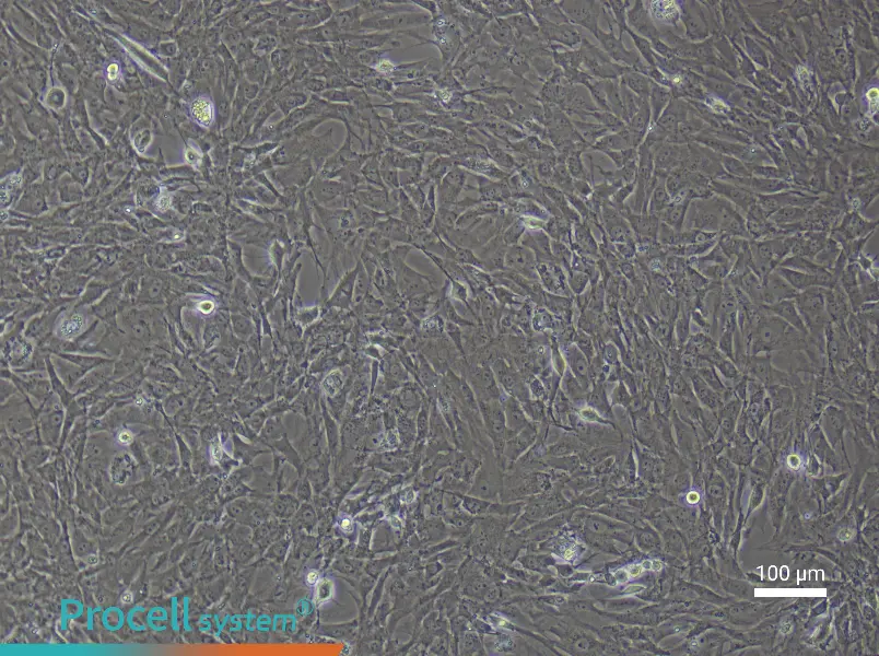 Rat Skeletal Muscle Fibroblast Complete Medium - 1