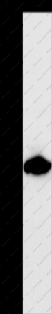 CALR Polyclonal Antibody - 1