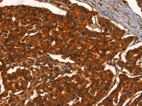 PRKD1 Polyclonal Antibody - 3