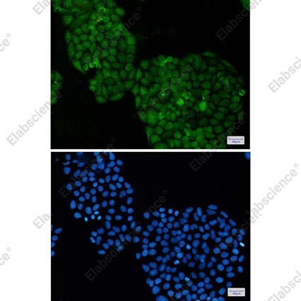 Recombinant ADRM1 Monoclonal Antibody - 2