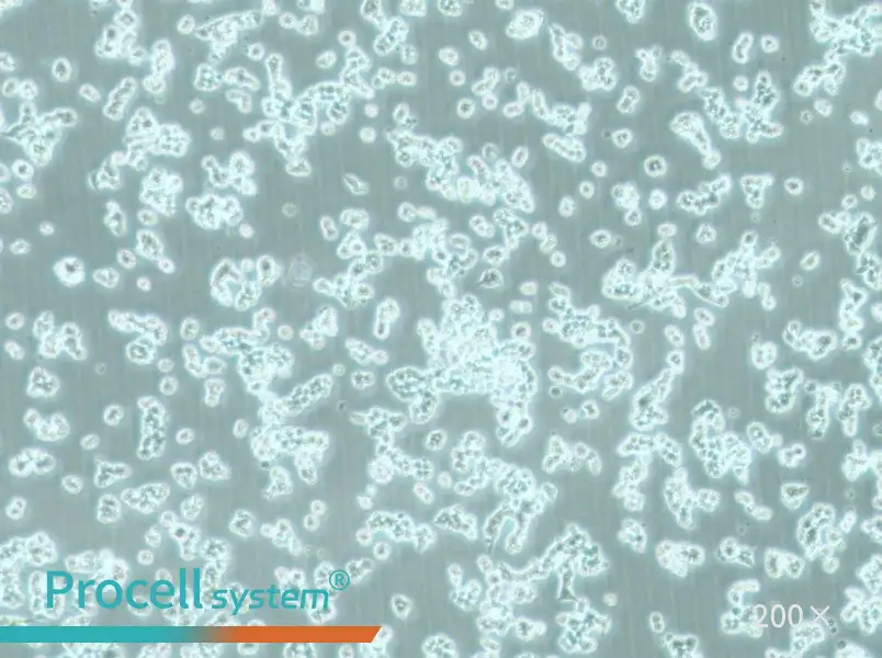 alpha TC1 clone 6 Cell Complete Medium - 5