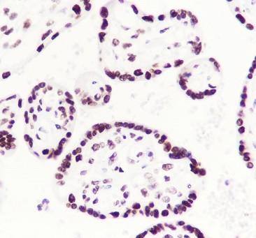 Recombinant RING1B Monoclonal Antibody - small - 2