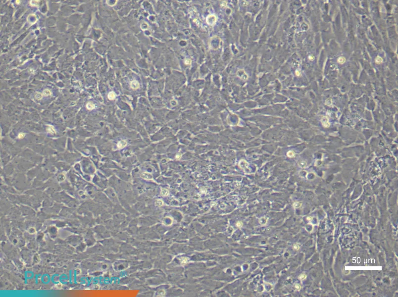 Rat Uterine Smooth Muscle (Primary cell immortalization) Cell Complete MediumRat Uterine Smooth Muscle (Primary cell immortalization) Cell Complete Medium - 4