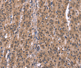 Histamine H1 Receptor Polyclonal Antibody - 3