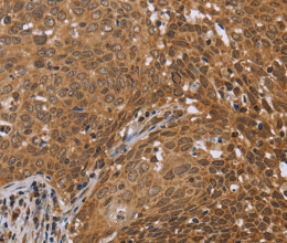FKBP8 Polyclonal Antibody - 3