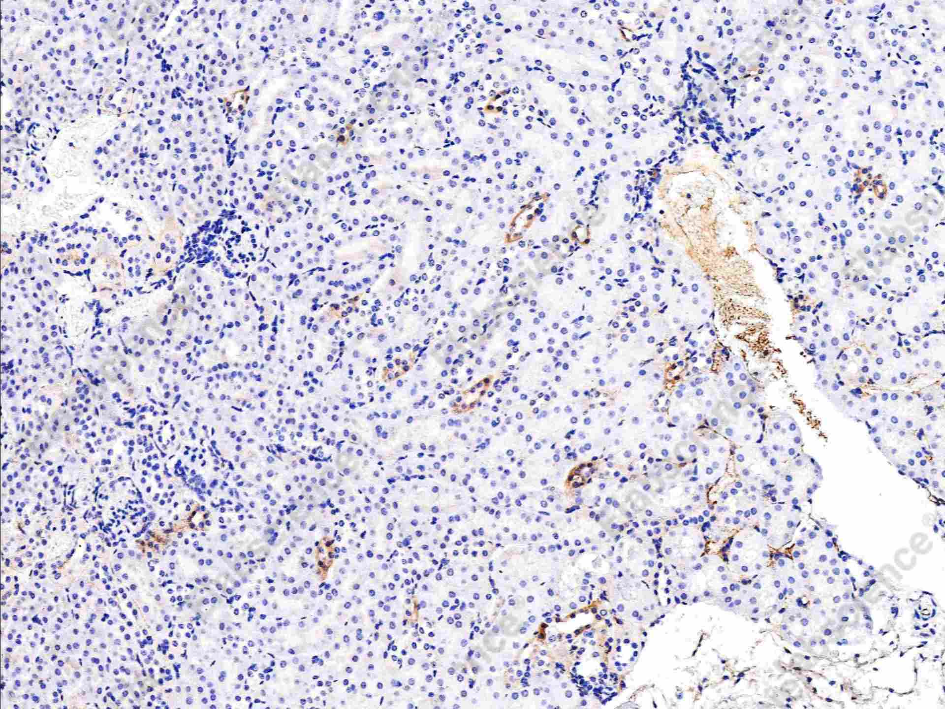 Recombinant Phospho-EGF Receptor (Tyr1068) Monoclonal Antibody - 2