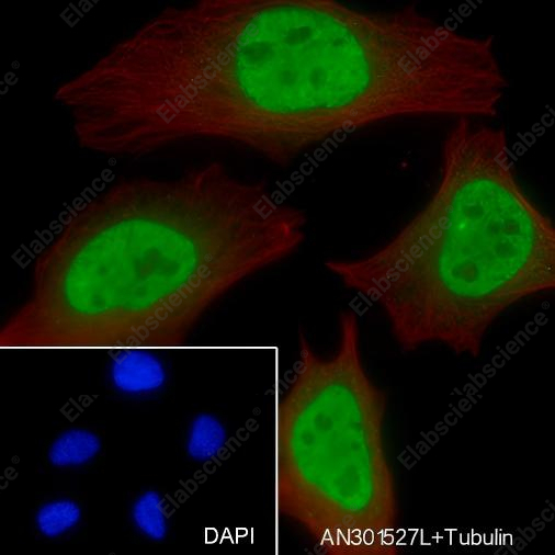 Recombinant FUBP1 Monoclonal Antibody - 6