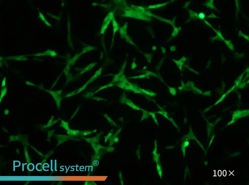 U-87 MG-GFP - 1