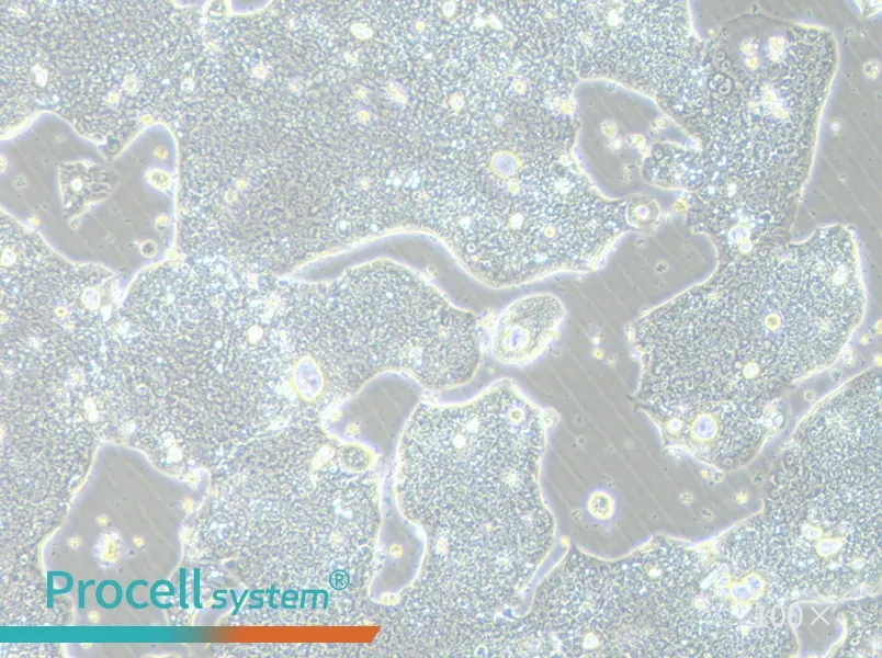 NCI-N87 [N87] Cell Complete Medium - 2