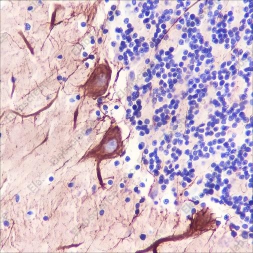 Recombinant PAK3 Monoclonal Antibody - 2