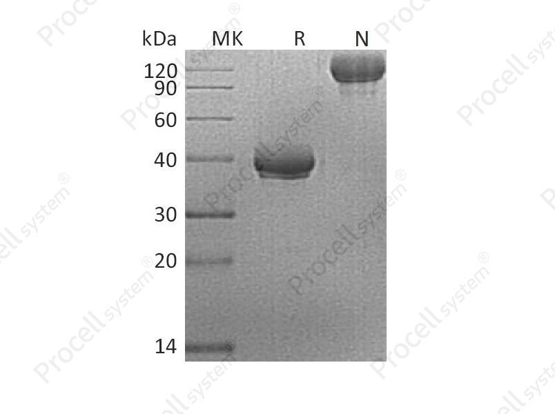 BCMA/TNFRSF17 (C-Fc), Human, Recombinant