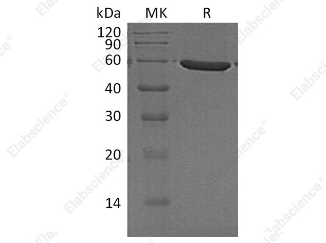 Recombinant Human PFKFB1 Protein (His Tag) - 1