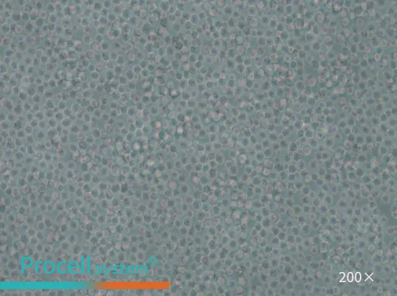 skm-1 Cell Complete Medium - small - 5