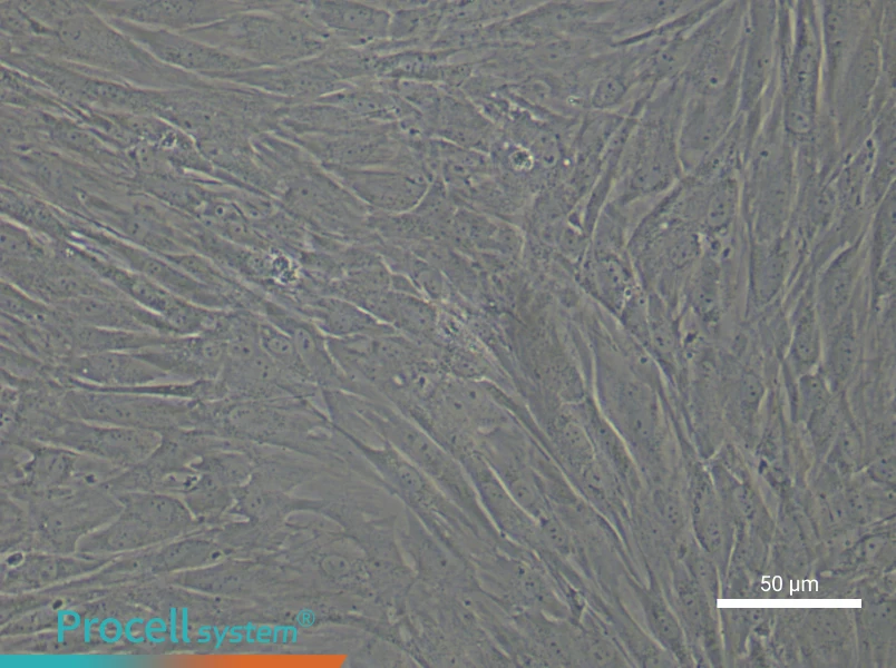 Human Keloid Fibroblast Complete Medium - small - 5