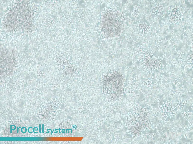 CCRF-SB Cell Complete Medium - 1