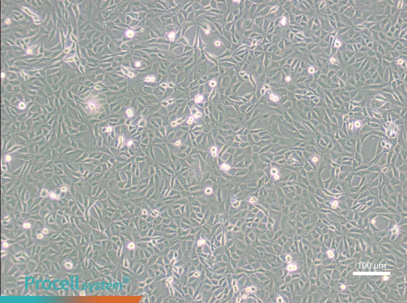 9L/lacZ Cell Complete Medium - 2