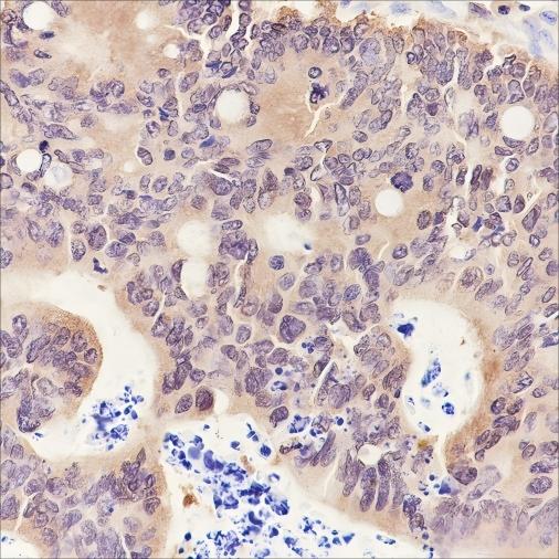 Recombinant PPM1A Monoclonal Antibody - small - 2