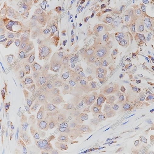 Recombinant c-erbB-3/HER-3 Monoclonal Antibody - 2
