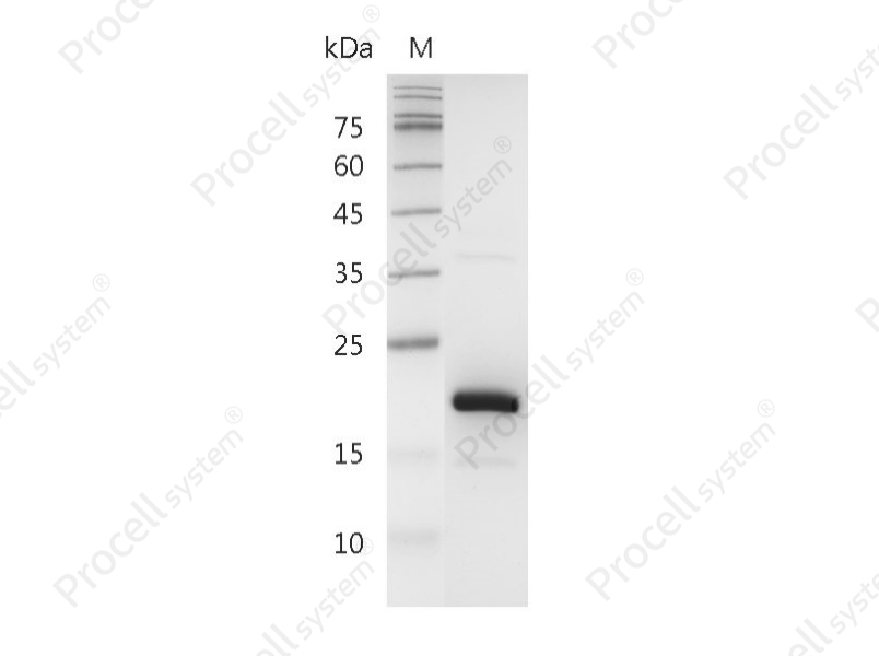 FGF-4/HST-1/HBGF-4, Human, Recombinant