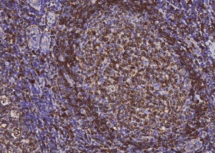 CD74 Monoclonal Antibody - small - 2