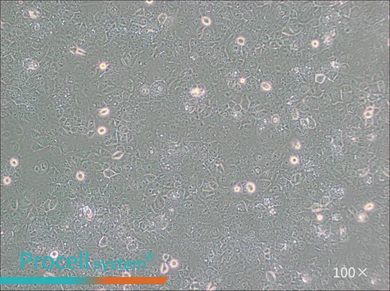 KYSE-30 Cell Complete Medium - 2