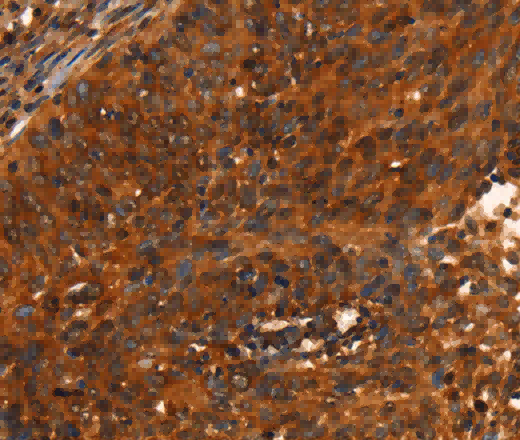 PRKD1 Polyclonal Antibody - 2
