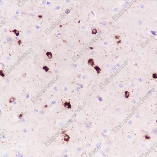 Recombinant Alpha B Crystallin Monoclonal Antibody - 4