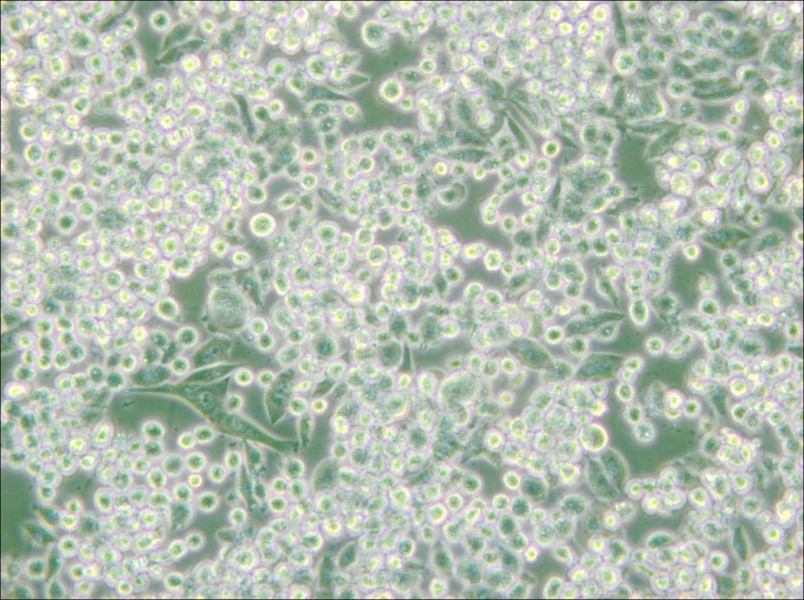 MIA PaCa-2 Cell Complete Medium - small - 5