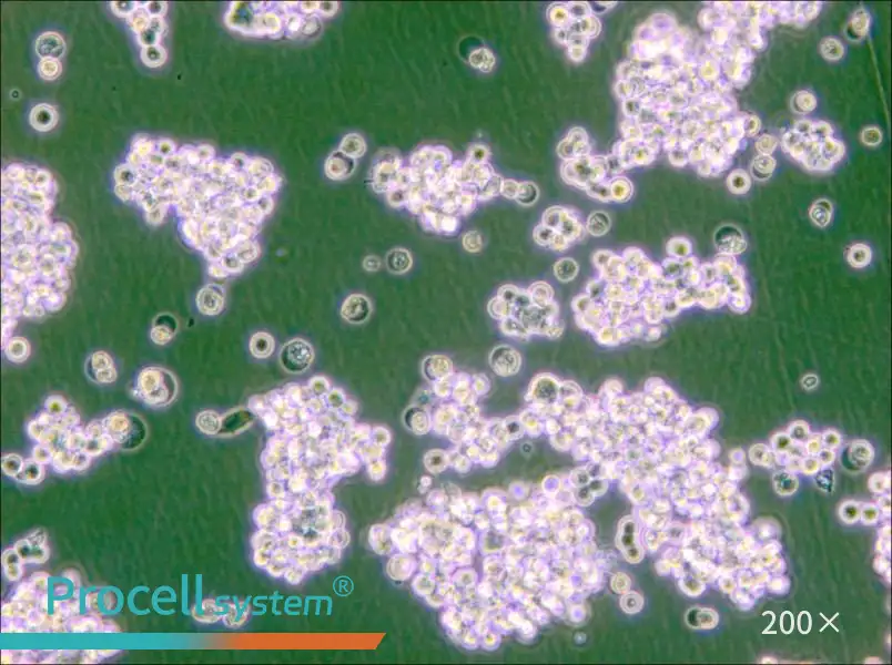 NCI-H524 Cell Complete Medium - 5