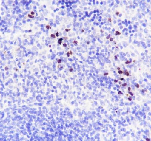 Recombinant MMP8 Monoclonal Antibody - 3