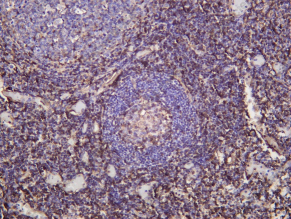 Recombinant CD225 Monoclonal Antibody - 1