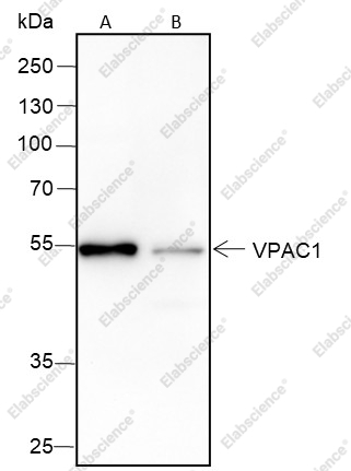 Recombinant VPAC1 Monoclonal Antibody - 1