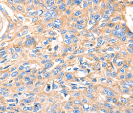 MVP Polyclonal Antibody - 3