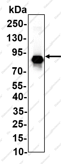 Recombinant Catenin-γ Monoclonal Antibody - 1