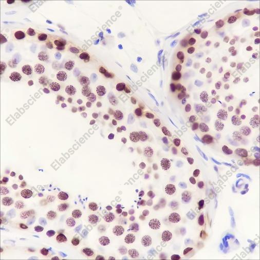Recombinant HMGA1 Monoclonal Antibody - 5