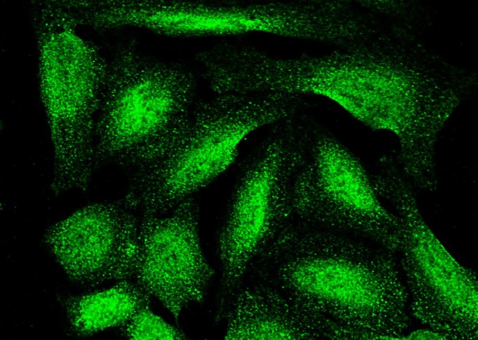 ASF1B Monoclonal Antibody-searchlist-1