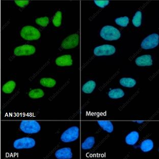Recombinant WSTF Monoclonal Antibody - 1
