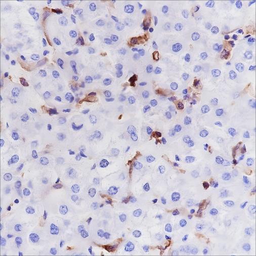 Recombinant HLA-DRA Monoclonal Antibody-searchlist-1