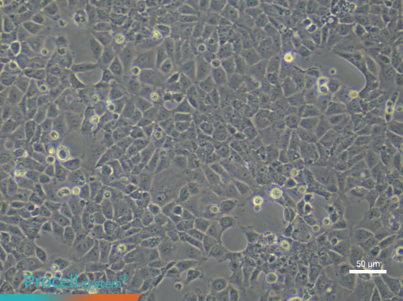 Rat Cardiac Fibroblast (Primary cell immortalization) Complete MediumRat Cardiac Fibroblast (Primary cell immortalization) Complete Medium - 4