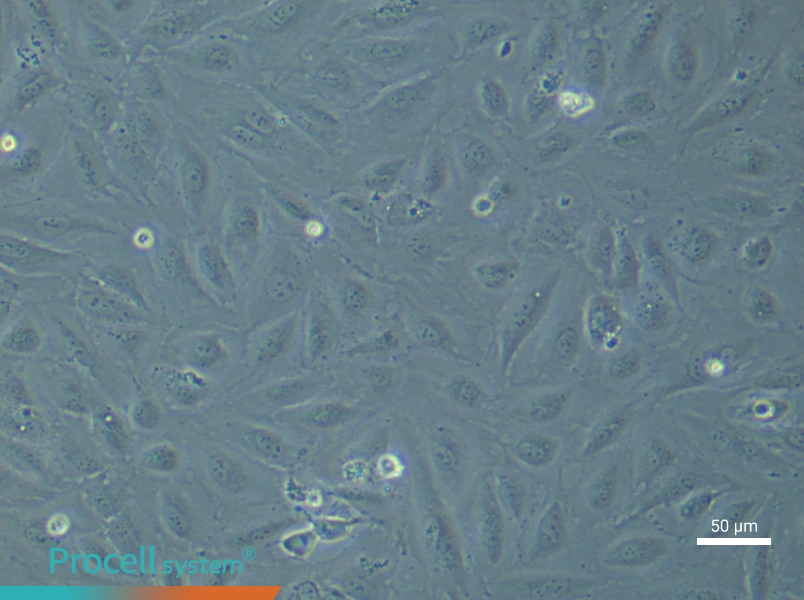 Human Endometrial Epithelial (Primary cell immortalization) Cell Complete MediumHuman Endometrial Epithelial (Primary cell immortalization) Cell Complete Medium - 6
