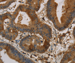 CK-16 Polyclonal Antibody - 2