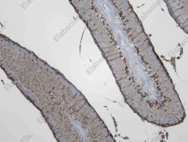 Recombinant Msi2 Monoclonal Antibody - 2