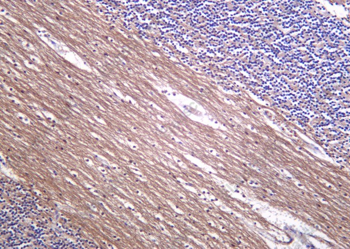 Recombinant Neurofilament (NF-L) Monoclonal Antibody - 1