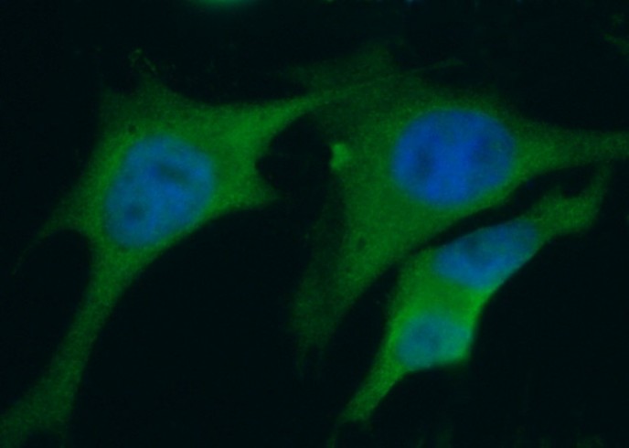 S100A6 Monoclonal Antibody - small - 2