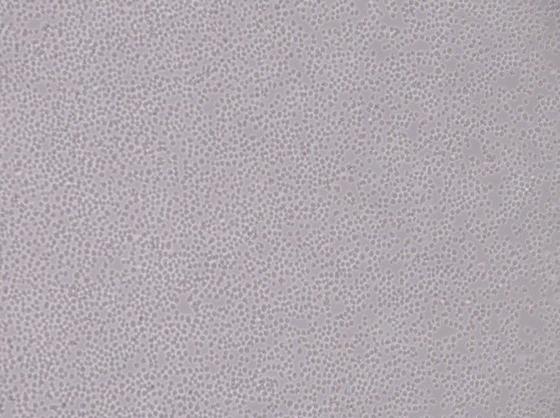 SU-DHL-8 Cell Complete Medium - 2