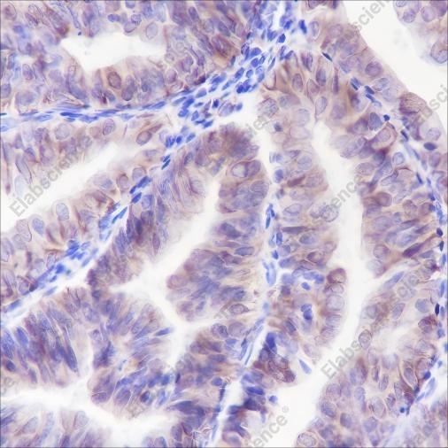 Recombinant ALOX15 Monoclonal Antibody - 1