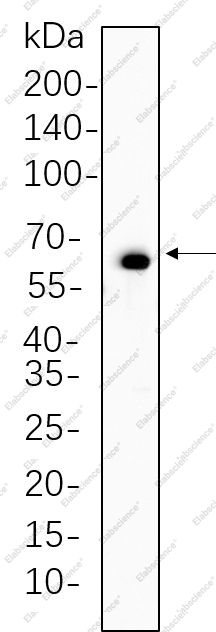 Recombinant Phospho-Paxillin (Tyr118) Monoclonal Antibody - 1