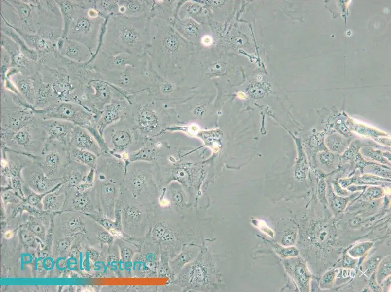NCI-H2347 Cell Complete Medium - 5