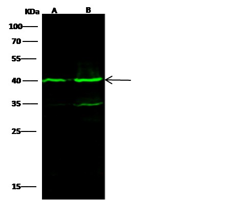 Isovaleryl-CoA dehydrogenase/IVD Monoclonal Antibody - small - 4