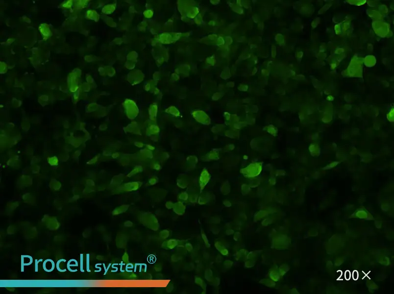 PC-3-GFP Cell Complete Medium - 3
